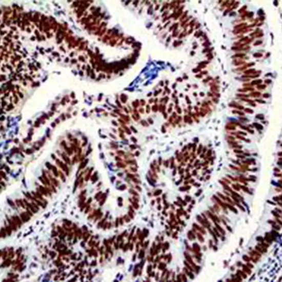 immunohistochemistry (ihc) - pms2